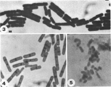 Light Micrograph Of Gram Positive Cells Of B Subtilis