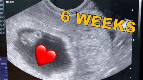 weeks  days pregnancy ultrasound heartbeat youtube
