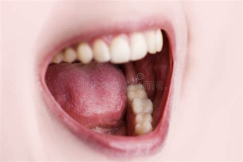 open mouth  teeth stock photo image  dental skin