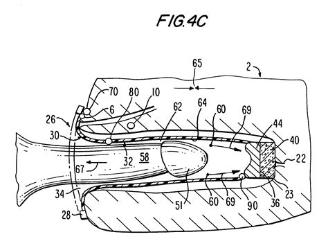 Patent Us7823591 Female Barrier Contraceptive With Vacuum Anchoring