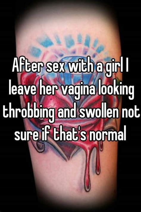 Swelling Of Vagina After Sex