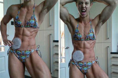 bodybuilder with ibs flaunts her muscles and colostomy bag daily star