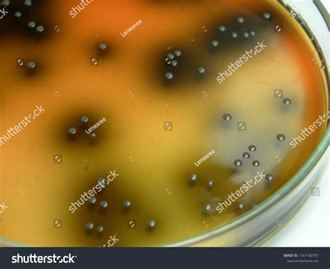 colonies listeria spp  palcam medium foto de stock
