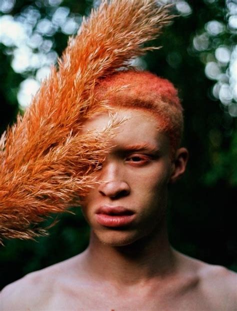 albino model on tumblr