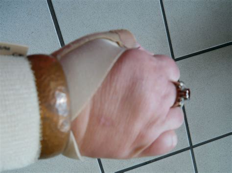 brace  bracelet cuff bracelet   wrist bra flickr