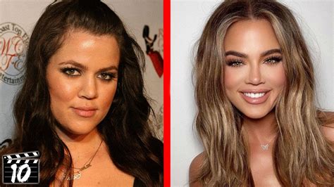Top 10 Celebrities Who Regret Their Plastic Surgery Youtube
