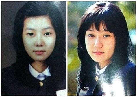 Netizens Suspect Im Soo Hyang Of Plastic Surgery After Old