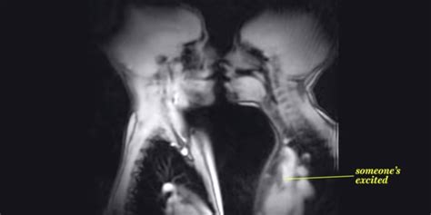 human sexual intercourse x ray