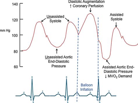 intra aortic balloon pump  high risk percutaneous coronary