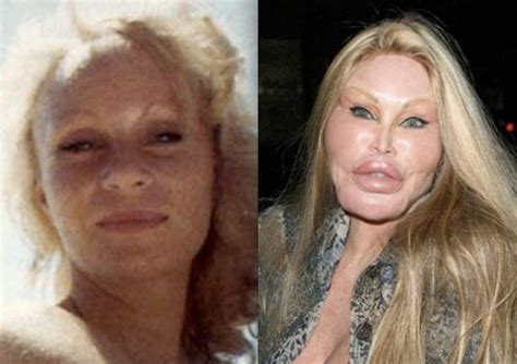 Picture Of Catwoman Plastic Surgery Picture Of