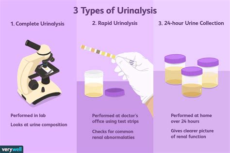 urinalysis  side effects procedure results