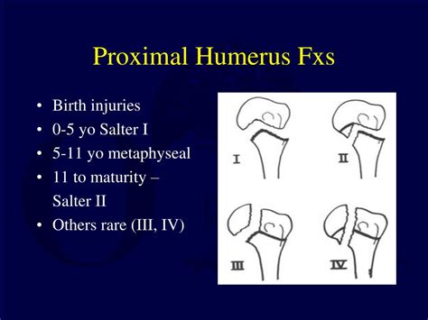 Ppt Fractures And Dislocations About The Shoulder In The