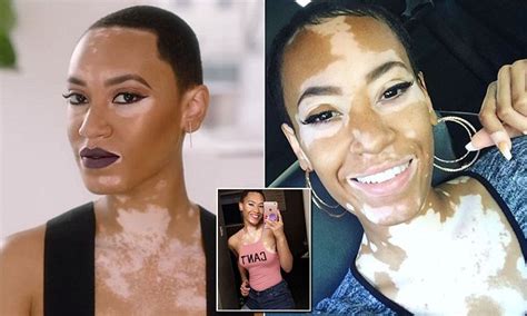 covergirl features its first model with vitiligo daily mail online