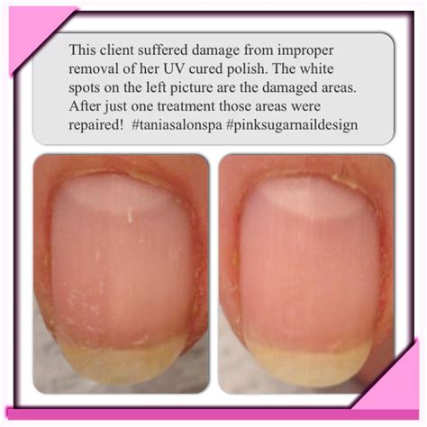 ibx cnd shellac sugar nails nail repair white polish pink sugar