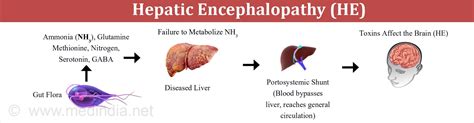 hepatic encephalopathy acupuncture   effects   liver master lus health center