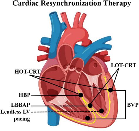 frontiers alternative pacing strategies  optimal cardiac