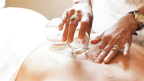 the benefits of cupping mpls st paul magazine