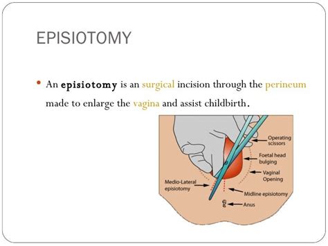 module  anatomy diseases