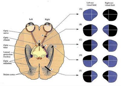 nasal visual field interpretation