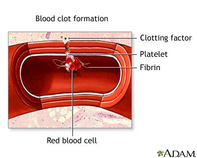 blood clot formation medlineplus medical encyclopedia image