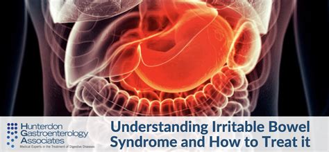 understanding irritable bowel syndrome    treat  hunterdon