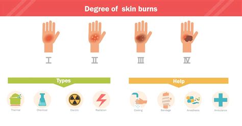 fourth degree burn diagram