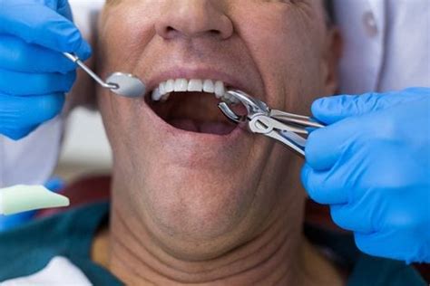 5 Reasons Why You May Need A Tooth Extraction Gentle Care Dentistry