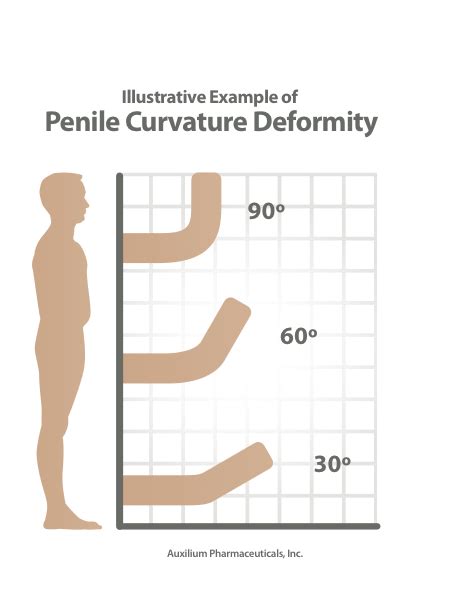 Possible Help For Men With Peyronie S Crooked Penis Disease Wbur News