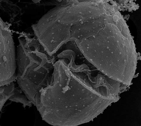 alexandrium minutum scanning electron micrograph flickr