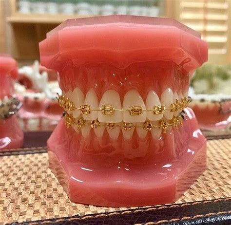 ginaleslie25 brackets dentales