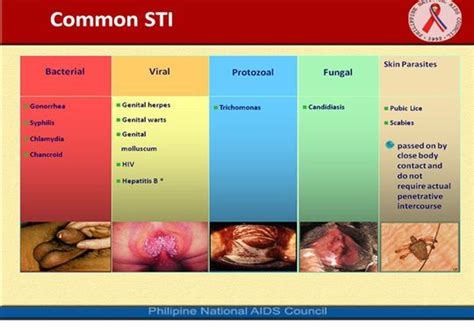 common sexually transmitted infections stis photo credit from philippine national aids