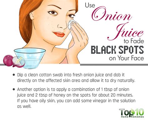 home remedies for black spots on your face page 3 of 3