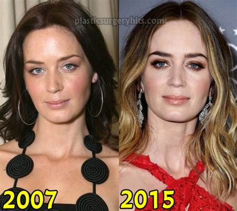 emily blunt plastic surgery    nose job  breast implants pictures