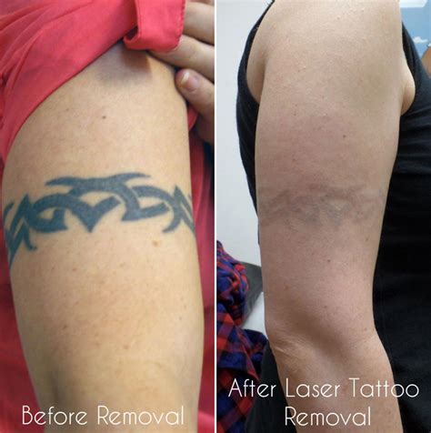 skin treatments  memphis   skin clinics