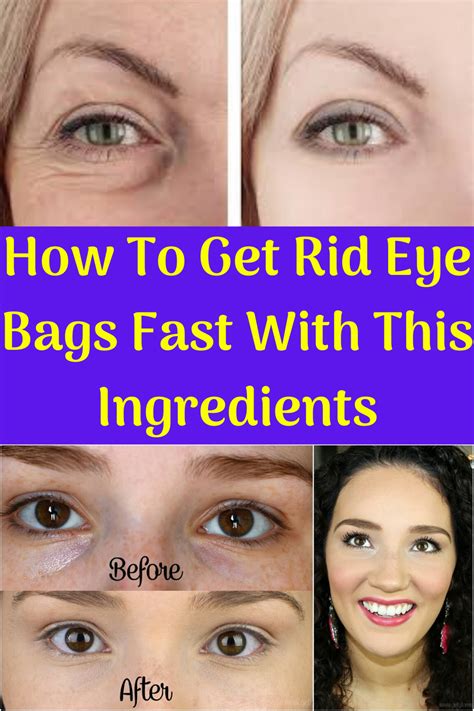 How To Get Rid Of Bags Under Ur Eyes