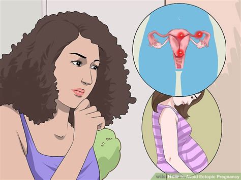 How To Reduce Your Risk Of Ectopic Pregnancy Ob Gyn Advice