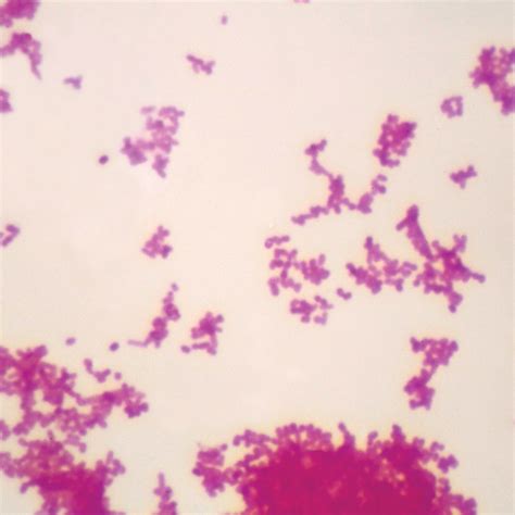 klebsiella pneumoniae wm microscope  carolina biological supply