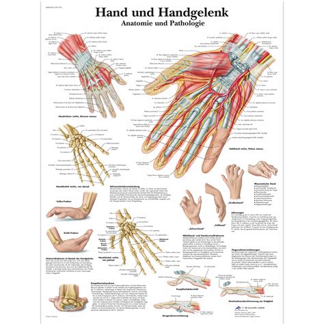 lehrtafel hand und handgelenk anatomie und pathologie
