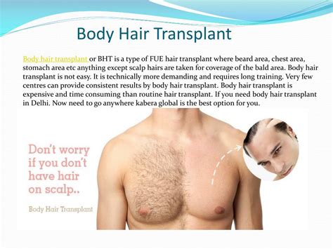 Ppt Welcome To Kabera Global Hair Transplant In Delhi Powerpoint