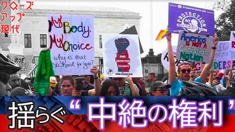 アメリカで相次ぐ中絶禁止 意図しない妊娠に日本での対応は Nhk クローズアップ現代 全記録