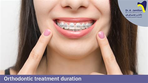 Orthodontic Treatment Duration Dr Jamilian