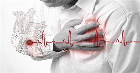 angina chest pain tightness symptoms types treatment