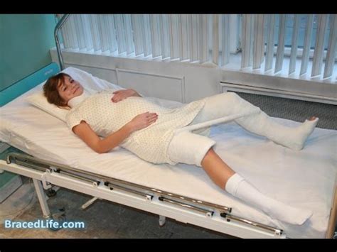 pregnant emily  double hip spica plaster cast youtube
