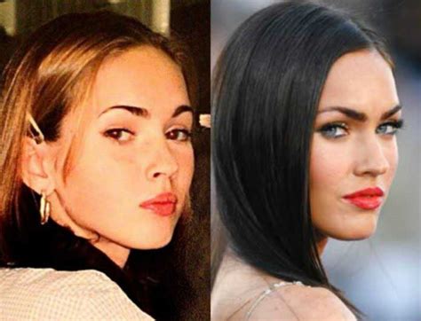 Megan Fox Before And After Plastic Surgery Boob Job And