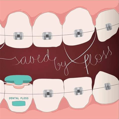 importance  flossing daily  wearing braces dentalehubcom