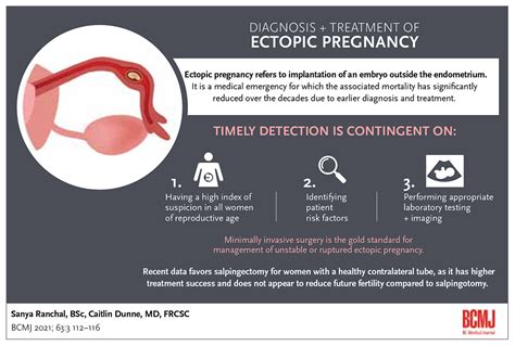 diagnosis  treatment  ectopic pregnancy british columbia medical