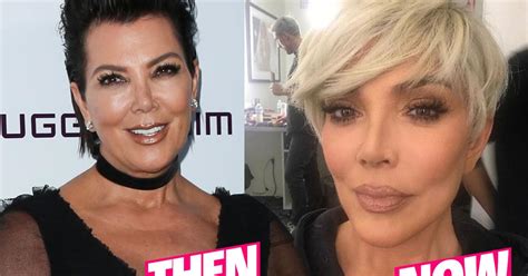 Kris Jenner Flaunts New Face After Plastic Surgery Makeover