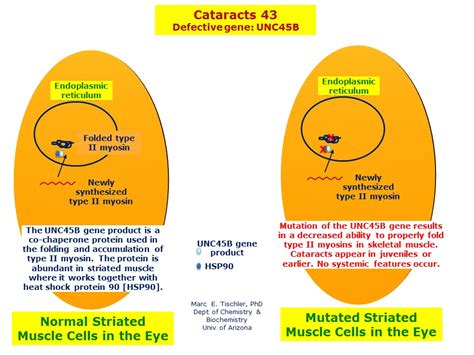 cataracts 43 hereditary ocular diseases