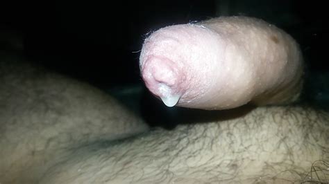 Tight Foreskin Dripping Cum Phimosis 3 Pics Xhamster