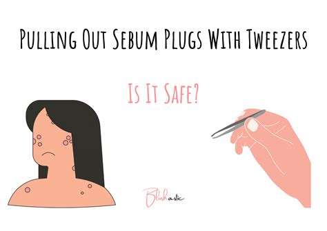 pulling out sebum plugs with tweezers is it safe blushastic